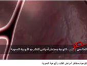 شاهد بالفيديو … اليوم العالمي للقلب.. التوعية والوقاية طريق الحفاظ على صحة الإنسان بصوت شيرين الشافعي