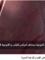 شاهد بالفيديو … اليوم العالمي للقلب.. التوعية والوقاية طريق الحفاظ على صحة الإنسان بصوت شيرين الشافعي